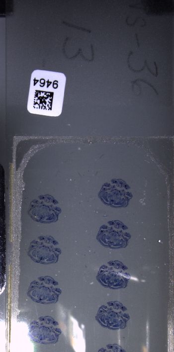 Media type: image; Special Collections 3102   shows specimen_part histological serial section;  Description: Whole slide scan, SC-3102, slide 13;